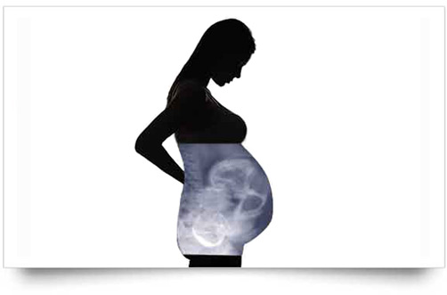Están Permitidos Los Rayos X Durante El Embarazo Bebe Y Amor 0436